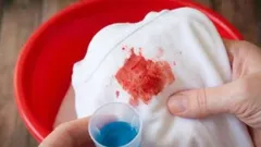 The expert shared her recipe for the best homemade stain remover. You will need 3 ingredients.