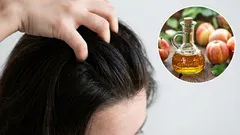 Hair will be thick and free of gray hair: how to make rinses from simple ingredients